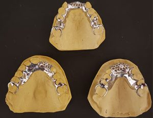 Prothèses partielles